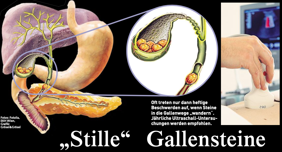 Gallensteine, Gallenblasenentzündung - Dr. med. Andreas Franczak