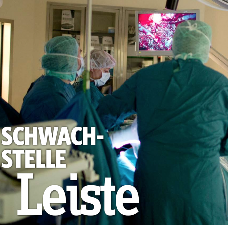 Leistenbruch (Leistenhernie) Ursache, Behandlung und Operation